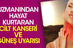 uzmanindan-hayat-kurtaran-cilt-kanseri-ve-gunes-uyarisi-er2jSBkv.jpg