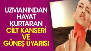 uzmanindan-hayat-kurtaran-cilt-kanseri-ve-gunes-uyarisi-er2jSBkv.jpg