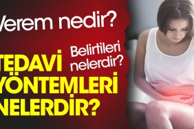 verem-nedir-verem-belirtileri-nelerdir-verem-tedavi-metotlari-nelerdir-VHpPILl3.jpg