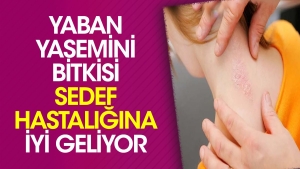 yaban-yasemini-bitkisi-sedef-hastaligina-l-geliyor-wvkvugnt.jpg