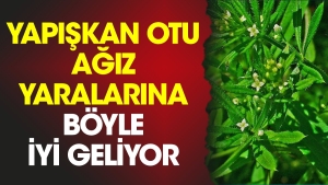 yapiskan-otu-agiz-yaralarina-bu-turlu-duzgun-geliyor-jXTAfQ1w.jpg
