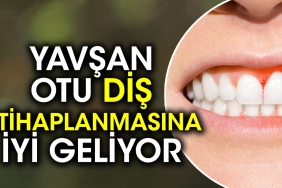 yavsan-otu-dis-iltihaplanmasina-uygun-geliyor-7d8ABFYR.jpg