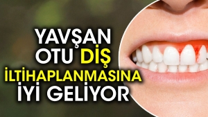 yavsan-otu-dis-iltihaplanmasina-uygun-geliyor-7d8ABFYR.jpg