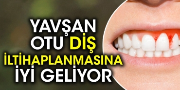 yavsan-otu-dis-iltihaplanmasina-uygun-geliyor-7d8ABFYR.jpg