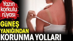 yazin-kaygili-dusu-gunes-yanigindan-korunma-yollari-FbJDTugV.jpg