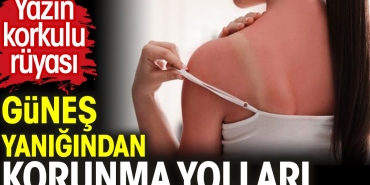 yazin-kaygili-dusu-gunes-yanigindan-korunma-yollari-FbJDTugV.jpg