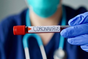 yeni-koronavirus-sars-cov-2-ve-yeni-koronavirus-hastaligi-covid-19-nedir-bpfcjeaQ.jpg