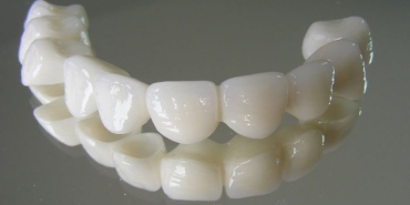 zirkonyum-protez-nedir-nasil-yapilir-bOpxOaDx.jpg
