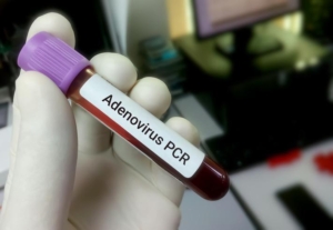 adenovirus-nedir-belirtileri-neler-nasil-bulasir-tolgahan-sayisman-uyardi-10-gundur-mucadele-veriyoruz-cocuklariniza-p2Yr9A8t.jpg