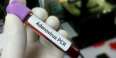 adenovirus-nedir-belirtileri-neler-nasil-bulasir-tolgahan-sayisman-uyardi-10-gundur-mucadele-veriyoruz-cocuklariniza-p2Yr9A8t.jpg
